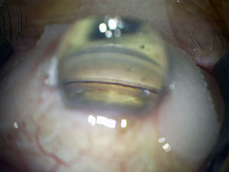 Brilliant View - Through OCULUS Quality Lens
